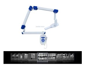 רנטגן דנטלי פרה אפיקלי לקיר 70KV